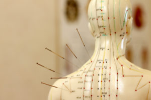 mannequin with acupuncture needles 