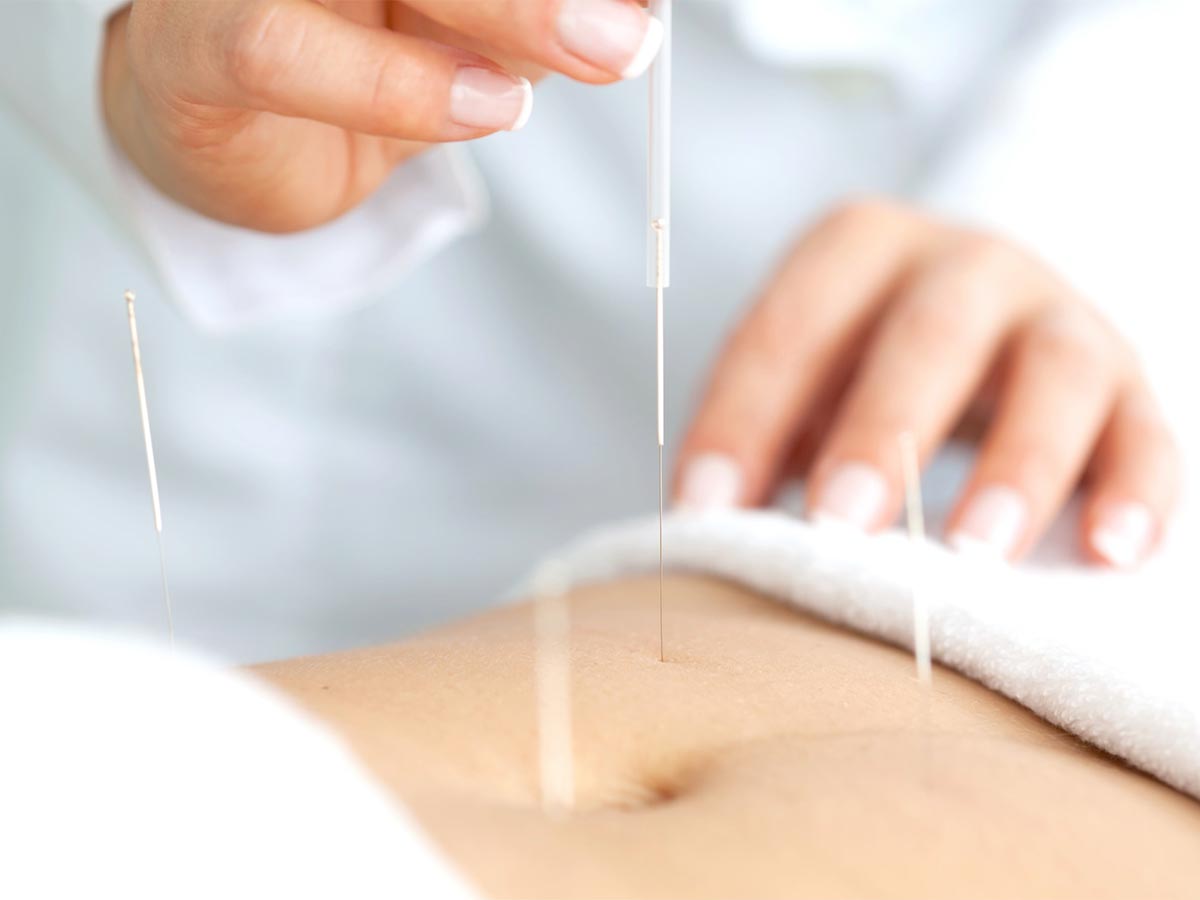 Melbourne Acupuncture and Wellness Centre provides acupuncture services.